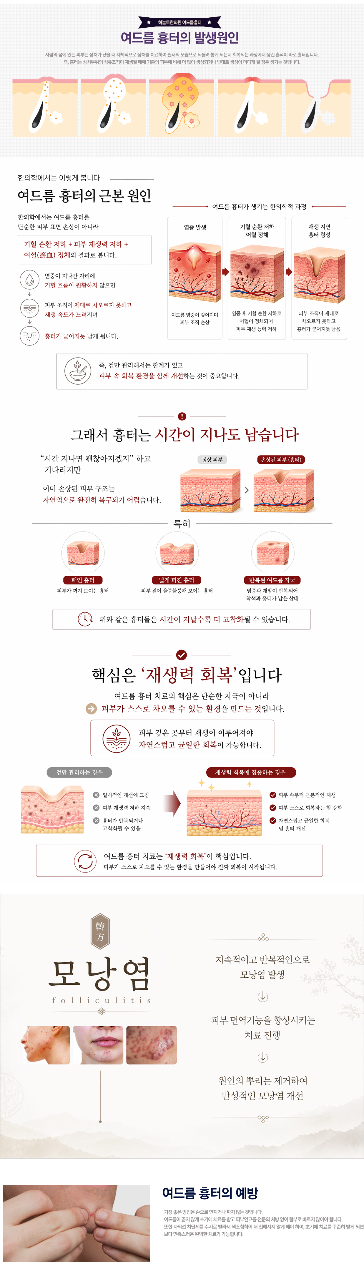 여드름흉터의 원인