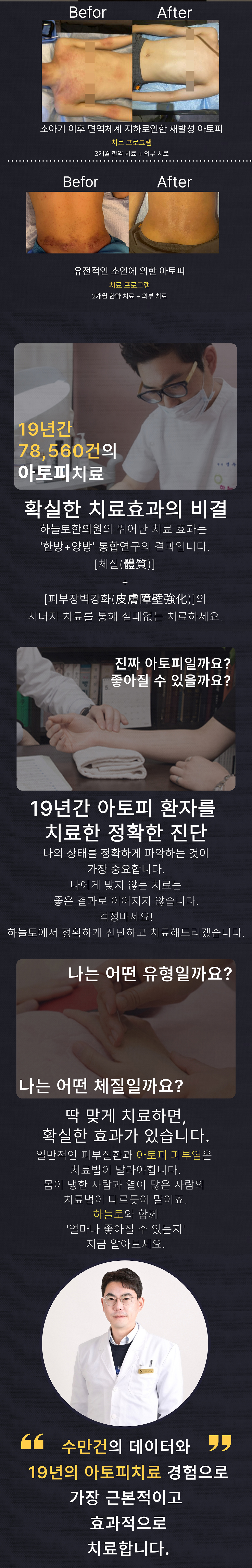 아토피의 원인