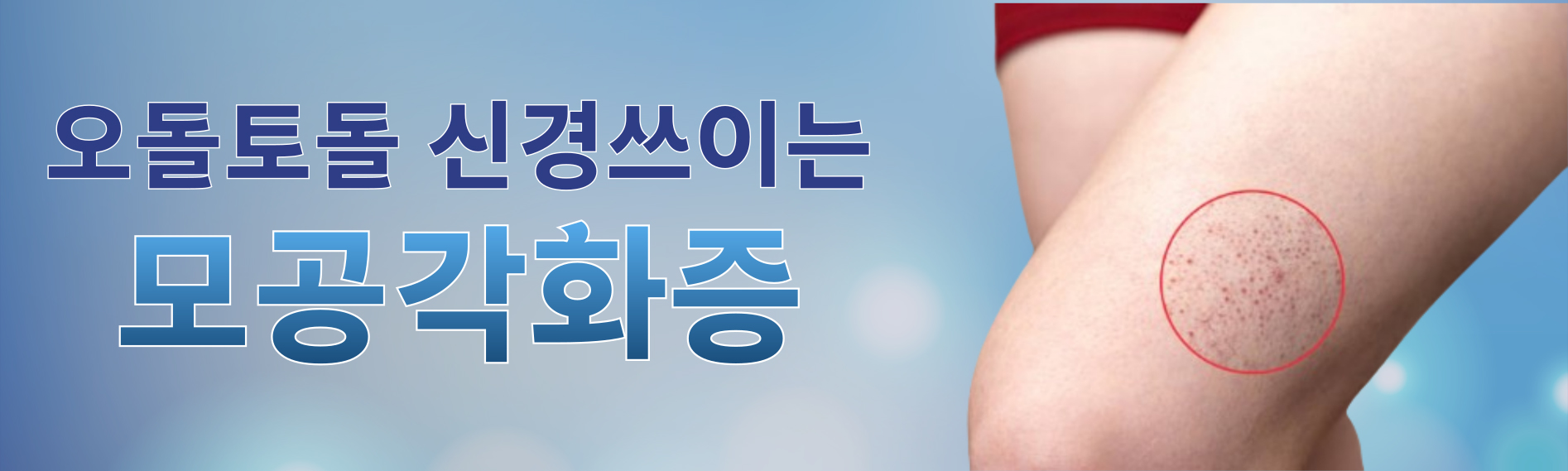 모낭염