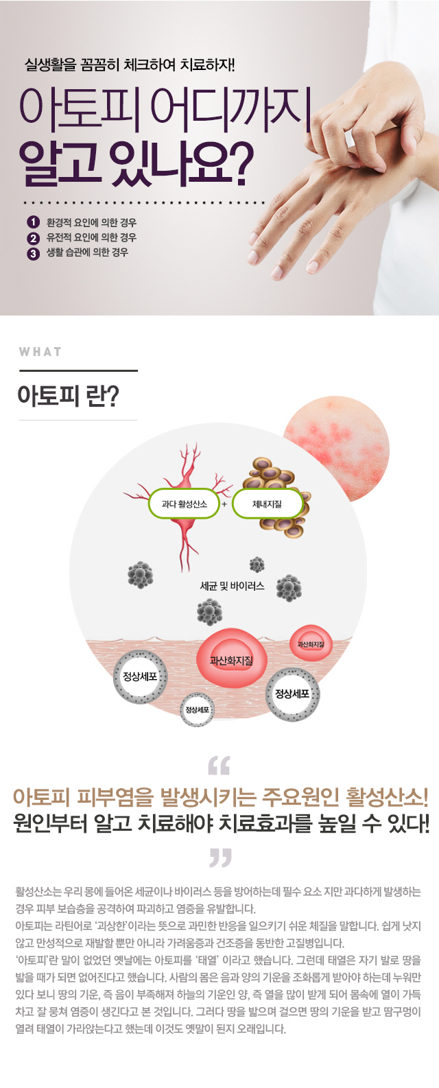 아토피의 원인