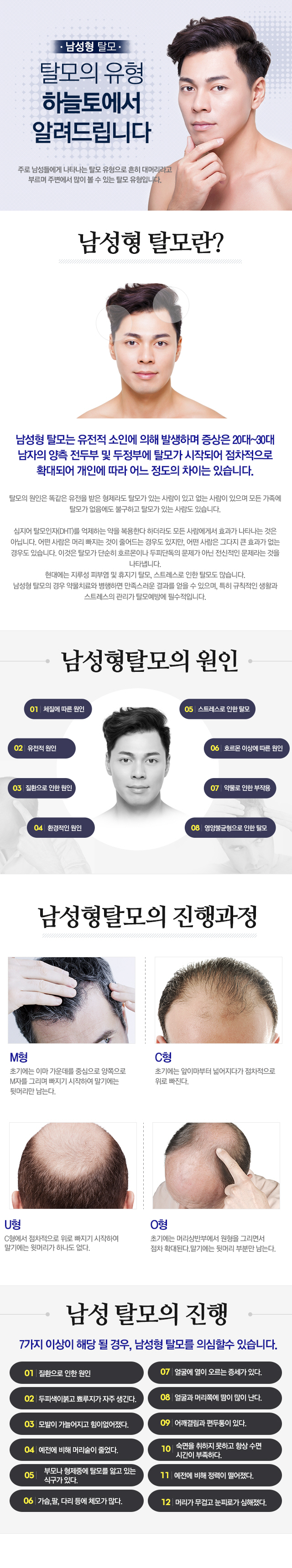 남성형 탈모